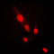 AKT Serine/Threonine Kinase 2 antibody, LS-C351826, Lifespan Biosciences, Immunofluorescence image 