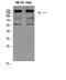 Integrin Subunit Beta 2 antibody, STJ96826, St John