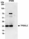 TPD52 Like 2 antibody, NBP2-36548, Novus Biologicals, Immunoprecipitation image 