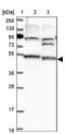 STAM Binding Protein Like 1 antibody, NBP1-89135, Novus Biologicals, Western Blot image 