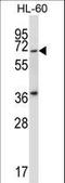 Protein Kinase, Membrane Associated Tyrosine/Threonine 1 antibody, LS-C164536, Lifespan Biosciences, Western Blot image 