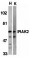 Interleukin 1 Receptor Associated Kinase 2 antibody, 2123, QED Bioscience, Western Blot image 