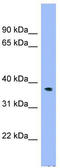 ADP-Ribose/CDP-Alcohol Diphosphatase, Manganese Dependent antibody, TA344800, Origene, Western Blot image 