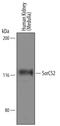 VPS10 domain-containing receptor SorCS2 antibody, AF4238, R&D Systems, Western Blot image 