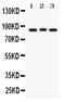 Semaphorin 3A antibody, PB9353, Boster Biological Technology, Western Blot image 