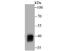Alcohol Dehydrogenase 1A (Class I), Alpha Polypeptide antibody, NBP2-75398, Novus Biologicals, Western Blot image 