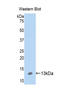 S100 Calcium Binding Protein A10 antibody, LS-C301109, Lifespan Biosciences, Western Blot image 