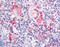 Integrin Subunit Alpha 2 antibody, TA341148, Origene, Immunohistochemistry frozen image 