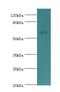 Cholinergic Receptor Muscarinic 3 antibody, LS-C375477, Lifespan Biosciences, Western Blot image 