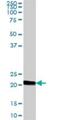 Joining Chain Of Multimeric IgA And IgM antibody, H00003512-B01P, Novus Biologicals, Western Blot image 