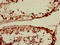 PHT2 antibody, CSB-PA815578LA01HU, Cusabio, Immunohistochemistry paraffin image 