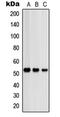 Protein Kinase CAMP-Dependent Type II Regulatory Subunit Beta antibody, LS-C352707, Lifespan Biosciences, Western Blot image 