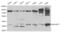 Rho guanine nucleotide exchange factor 7 antibody, PA5-75963, Invitrogen Antibodies, Western Blot image 