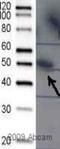 Protein Kinase CAMP-Dependent Type II Regulatory Subunit Alpha antibody, ab32390, Abcam, Western Blot image 