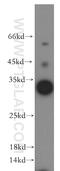 HAUS Augmin Like Complex Subunit 4 antibody, 20104-1-AP, Proteintech Group, Western Blot image 