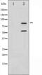 Phosphoinositide-3-Kinase Regulatory Subunit 1 antibody, abx011346, Abbexa, Western Blot image 