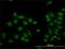 Lysine Demethylase 5B antibody, H00010765-M02, Novus Biologicals, Immunofluorescence image 