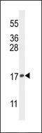 H3 Histone Family Member 3B antibody, MBS9209583, MyBioSource, Western Blot image 