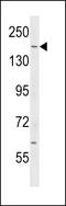 Ras GTPase-activating-like protein IQGAP2 antibody, LS-C159929, Lifespan Biosciences, Western Blot image 