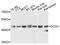 Glutaryl-CoA Dehydrogenase antibody, A03139, Boster Biological Technology, Western Blot image 