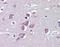 Transient Receptor Potential Cation Channel Subfamily M Member 2 antibody, orb89417, Biorbyt, Immunohistochemistry paraffin image 