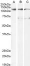 Oncostatin M Receptor antibody, PA5-37911, Invitrogen Antibodies, Western Blot image 
