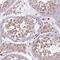 Tetratricopeptide Repeat Domain 12 antibody, NBP2-58627, Novus Biologicals, Immunohistochemistry frozen image 