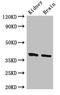 FOXE1 antibody, orb48204, Biorbyt, Western Blot image 
