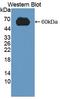 Low Density Lipoprotein Receptor antibody, LS-C372654, Lifespan Biosciences, Western Blot image 