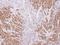 SS-A antibody, LS-C186316, Lifespan Biosciences, Immunohistochemistry paraffin image 