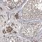 Cathepsin A antibody, NBP1-89728, Novus Biologicals, Immunohistochemistry paraffin image 