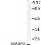 Cellular Retinoic Acid Binding Protein 2 antibody, LS-C177446, Lifespan Biosciences, Western Blot image 