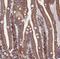 Metadherin antibody, NBP1-90328, Novus Biologicals, Immunohistochemistry paraffin image 