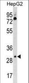 Cyclin Dependent Kinase 6 antibody, LS-C158185, Lifespan Biosciences, Western Blot image 