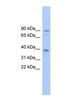 Transmembrane Channel Like 8 antibody, NBP1-57812, Novus Biologicals, Western Blot image 