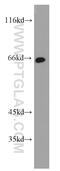 Calpain 9 antibody, 17556-1-AP, Proteintech Group, Western Blot image 