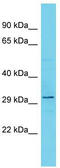 Testis Expressed 13B antibody, TA330698, Origene, Western Blot image 