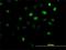 Ankyrin repeat domain-containing protein 1 antibody, H00027063-B02P, Novus Biologicals, Immunofluorescence image 