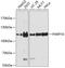 Poly(ADP-Ribose) Polymerase Family Member 10 antibody, GTX66119, GeneTex, Western Blot image 