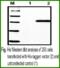 Histidine Ammonia-Lyase antibody, MBS415105, MyBioSource, Western Blot image 