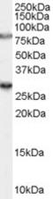 Synaptic Vesicle Glycoprotein 2A antibody, orb19294, Biorbyt, Western Blot image 