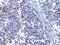 Interferon Induced With Helicase C Domain 1 antibody, PA5-20338, Invitrogen Antibodies, Immunohistochemistry paraffin image 