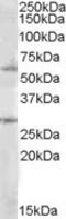 Suppressor Of Cytokine Signaling 7 antibody, MBS421810, MyBioSource, Western Blot image 