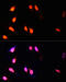 SET Domain Containing 2, Histone Lysine Methyltransferase antibody, 18-990, ProSci, Immunofluorescence image 