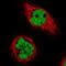 Chromosome 17 Open Reading Frame 49 antibody, NBP1-82670, Novus Biologicals, Immunocytochemistry image 