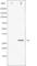 Cyclin Dependent Kinase Inhibitor 1B antibody, abx011963, Abbexa, Western Blot image 