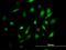 Bone Marrow Stromal Cell Antigen 2 antibody, H00000684-B02P, Novus Biologicals, Immunocytochemistry image 