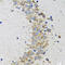 Cyclin Dependent Kinase 1 antibody, LS-C330847, Lifespan Biosciences, Immunohistochemistry frozen image 