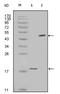 Baculoviral IAP repeat-containing protein 5 antibody, AM06207SU-N, Origene, Western Blot image 