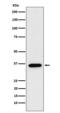 Fructose-Bisphosphatase 1 antibody, M01377, Boster Biological Technology, Western Blot image 